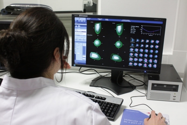 العلاج بالأشعة: علاج اليود